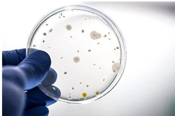 Autism and the Gut Brain Axis