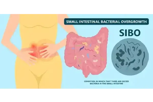SIBO and Acne: How Gut Health Impacts Your Skin
