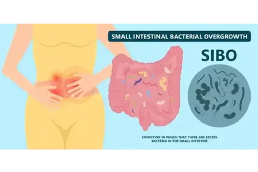 SIBO and Acne: How Gut Health Impacts Your Skin